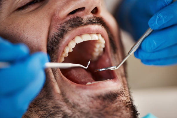 Best Emergency Gum Treatment in Watsessing, NJ