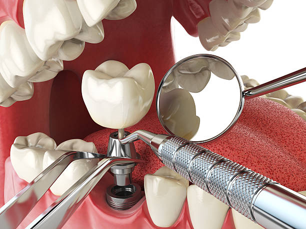 Best Emergency Denture Repair in Watsessing, NJ